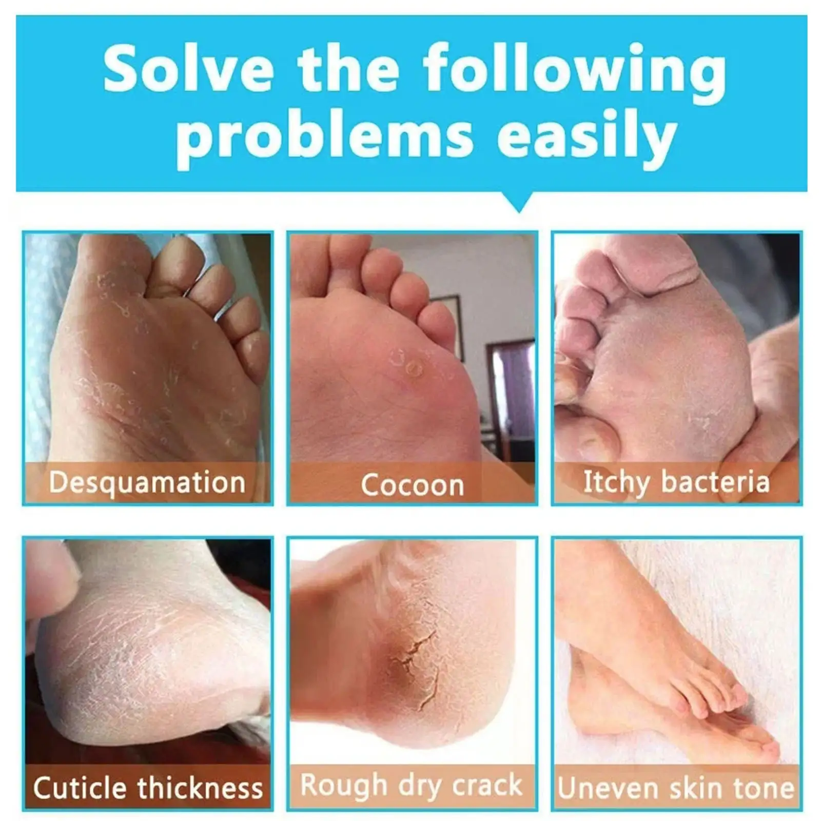 Exfoliating Hydrating Repair Tender And Smooth Hand And Foot Membrane