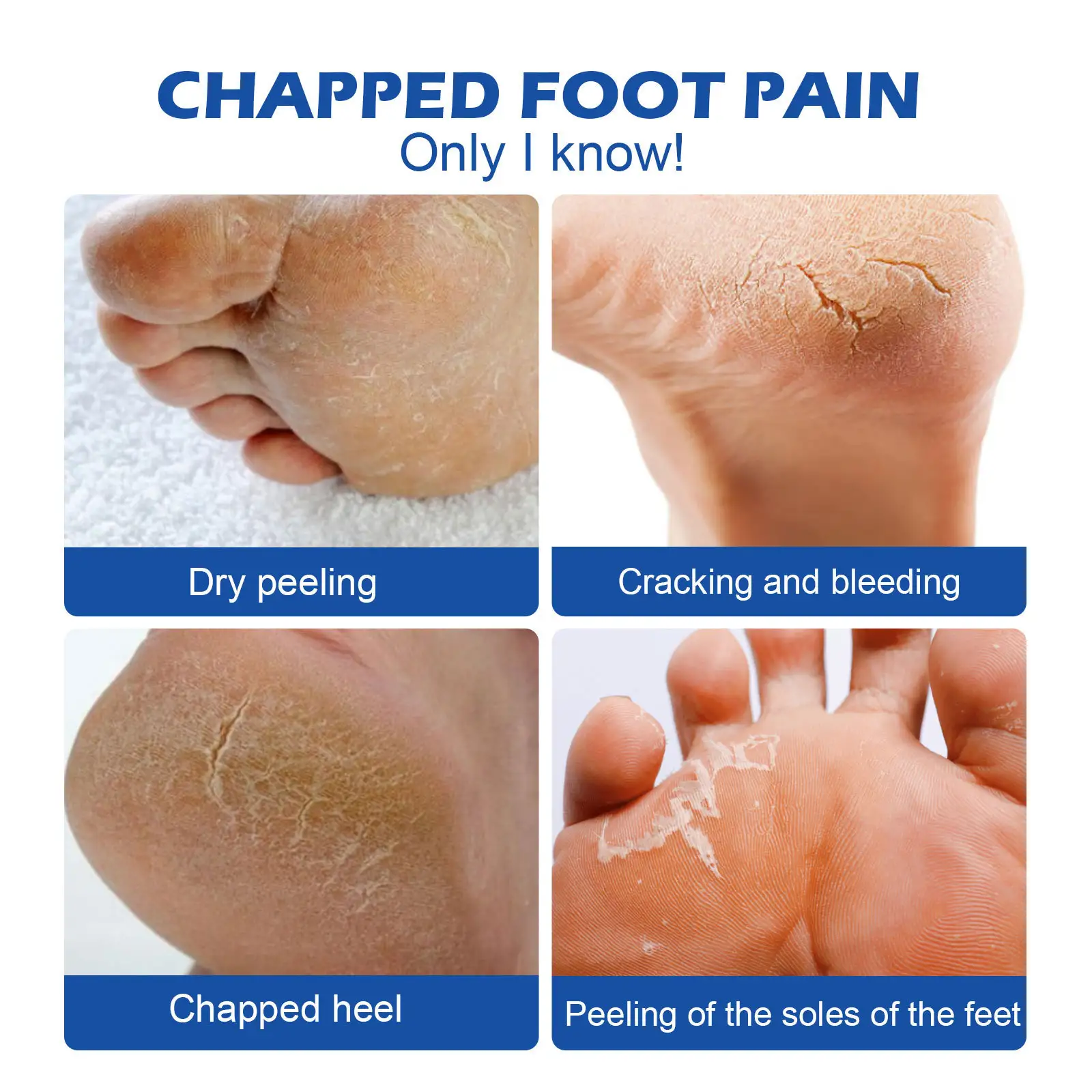 Skin Anti-freeze Chapped And Peeling Body Moisturizing