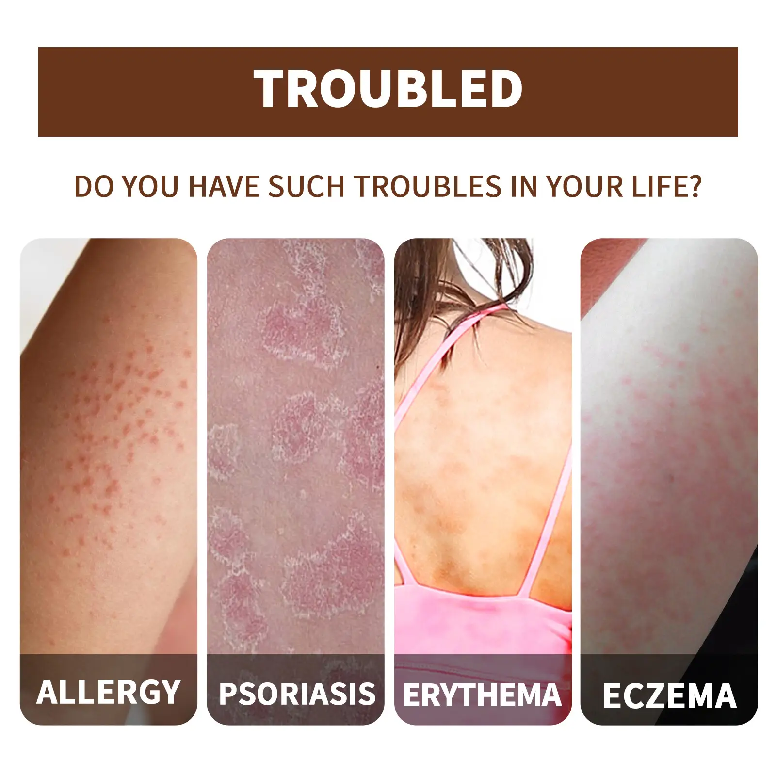 Skin Moss Repair Essential Oil Relieves Itching