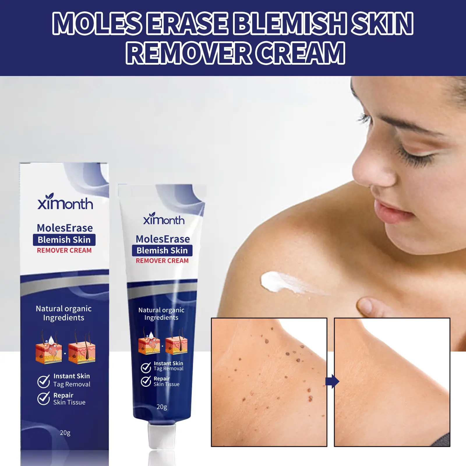 Wart Skin Cleaning Repair Fade Mole Flesh Bump Filiform Flat Neck Cream