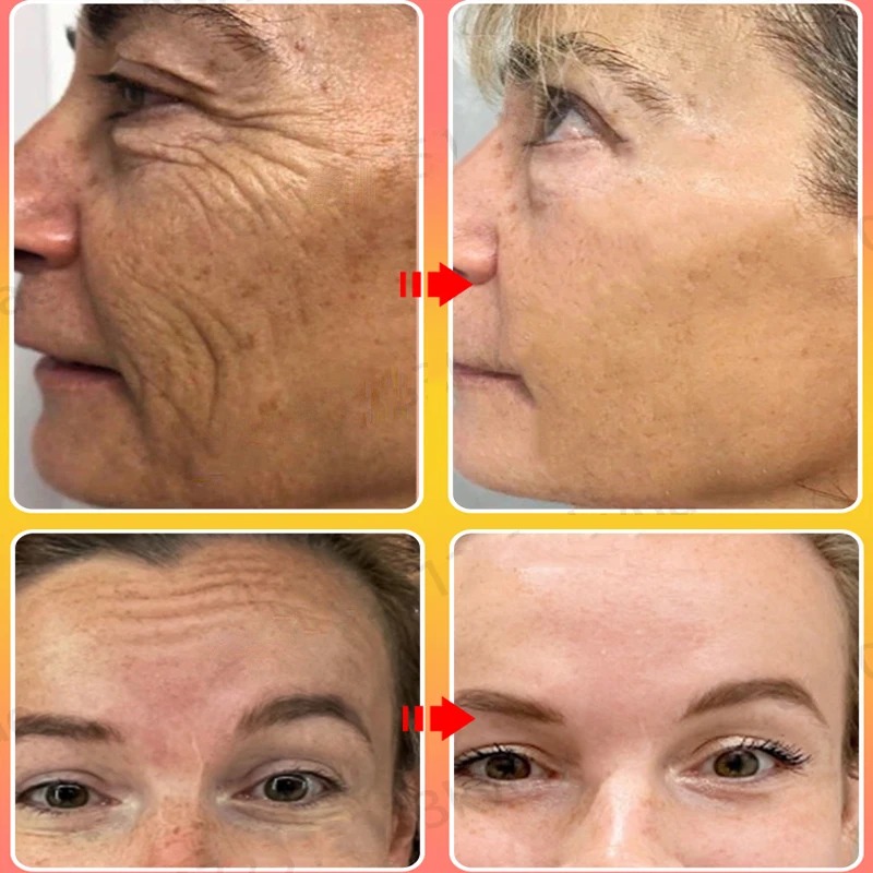 Retinol Royal Age Longxue Cream 50g Brightening Skin Color