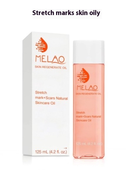 125ml Stretch Marks In Oil