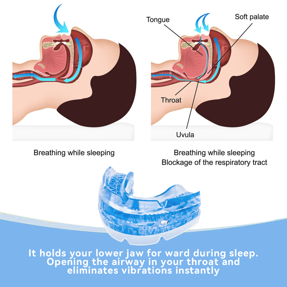 Title 3, Adjustable Tooth Socket Night Anti-wear Screw A...