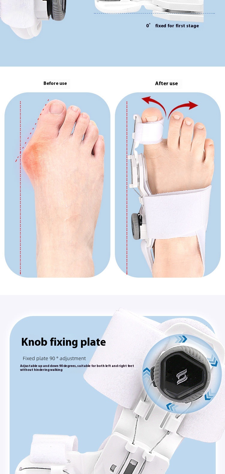 Title 6, Thumb Valgus Varus Knob Adjustment Angle Large ...