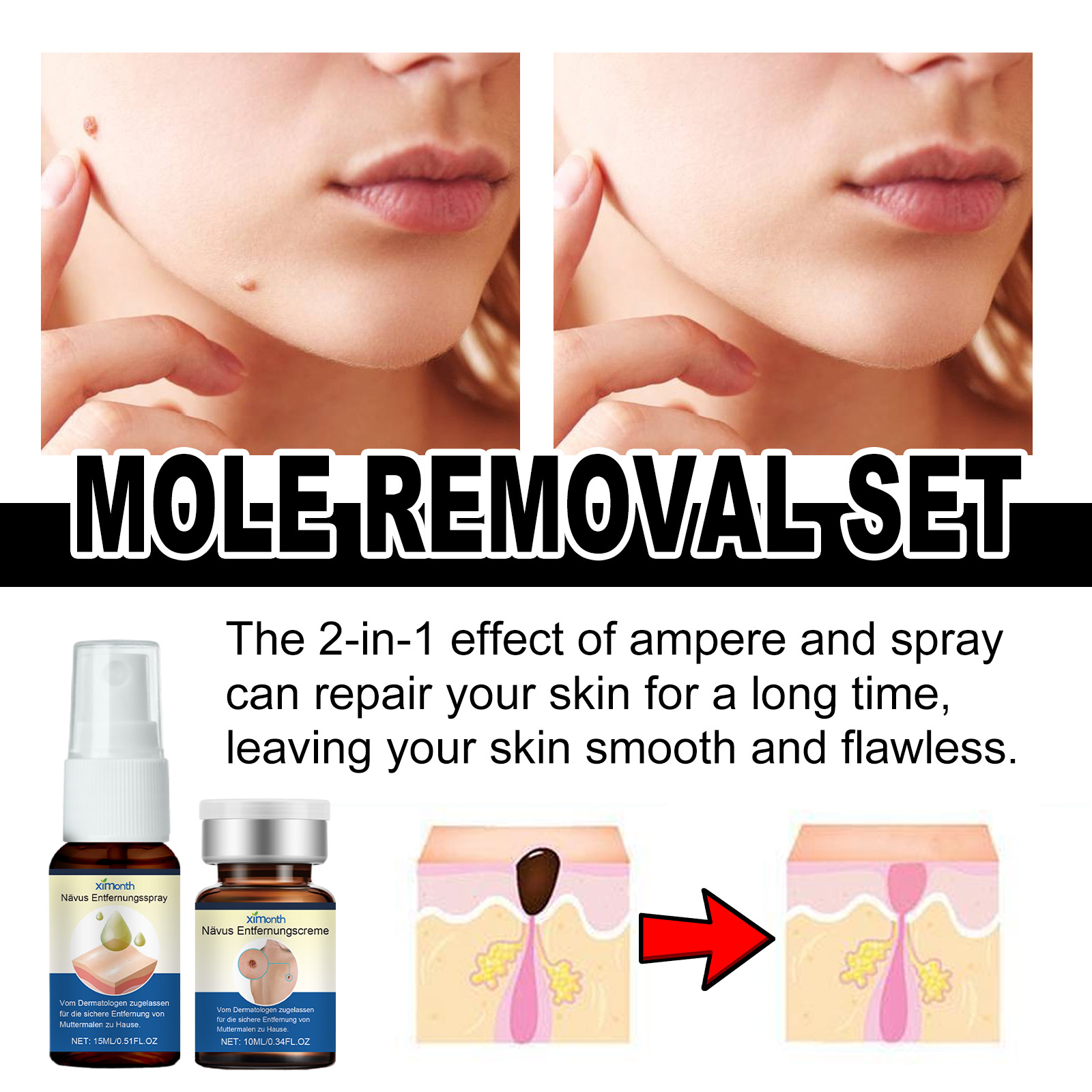 Title 5, Skin Mole Care Suit Body Cleaning