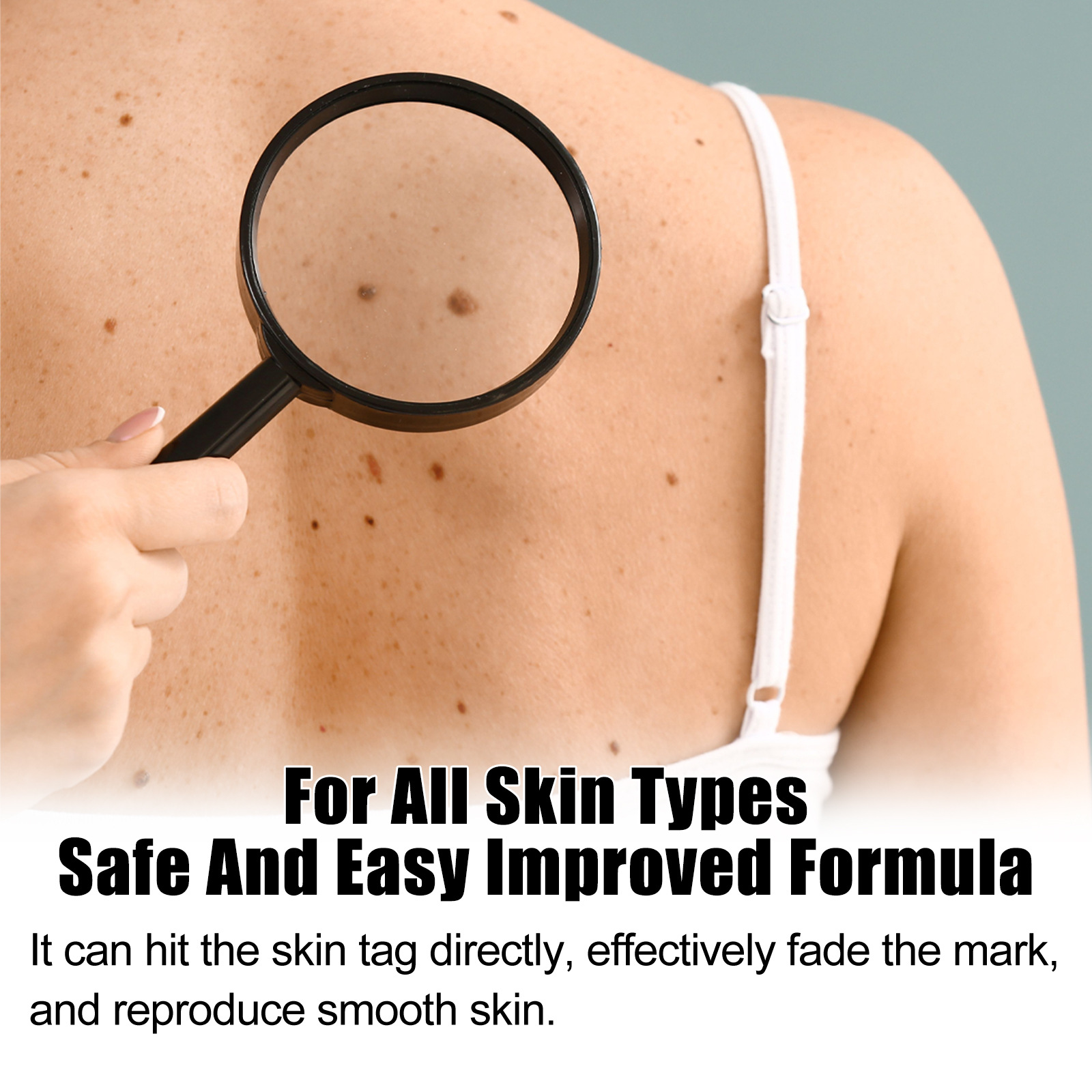 Title 4, Skin Mole Care Suit Body Cleaning