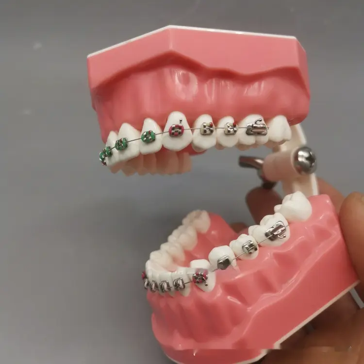 Orthodontic Brushing Guidance Model For Neat Teeth Alignment