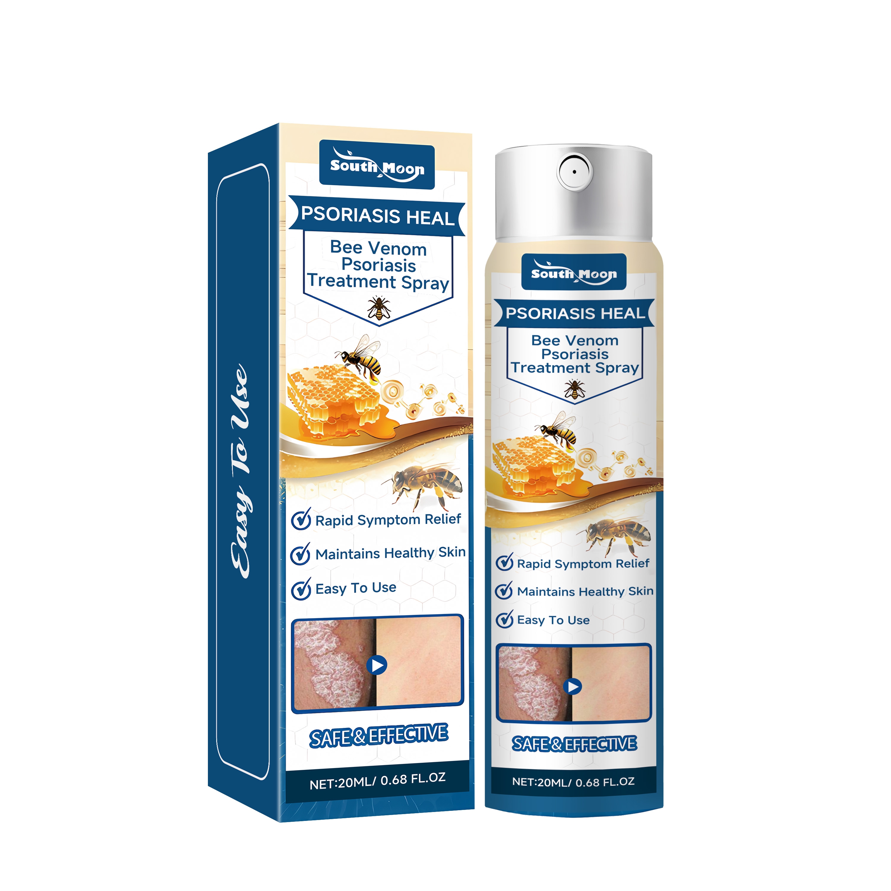 20ML