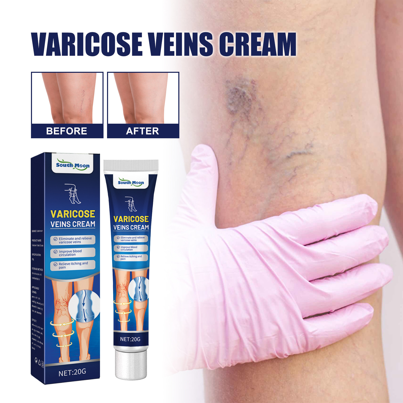 Title 1, Vein Massage Qu Zhang Cream Repairs Bulge Venat...