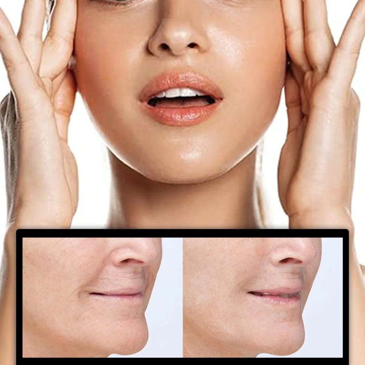 Face Lift Tightening Cream Light French Pattern Lift Image 1