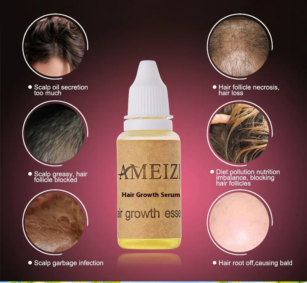 Hair Growth anti Loss Liquid 20ml