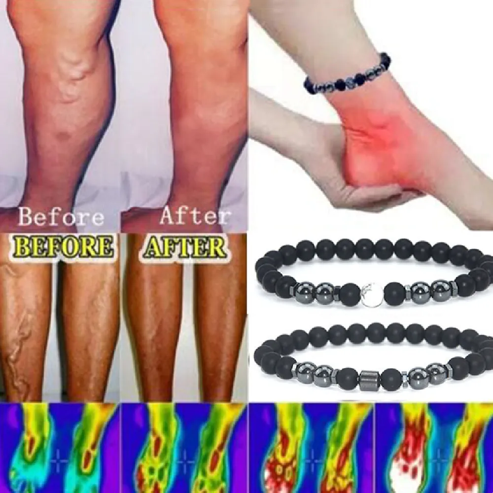 Frosted Black Beads Magnet Anklet European And American Retro Magnetic Foot Accessories