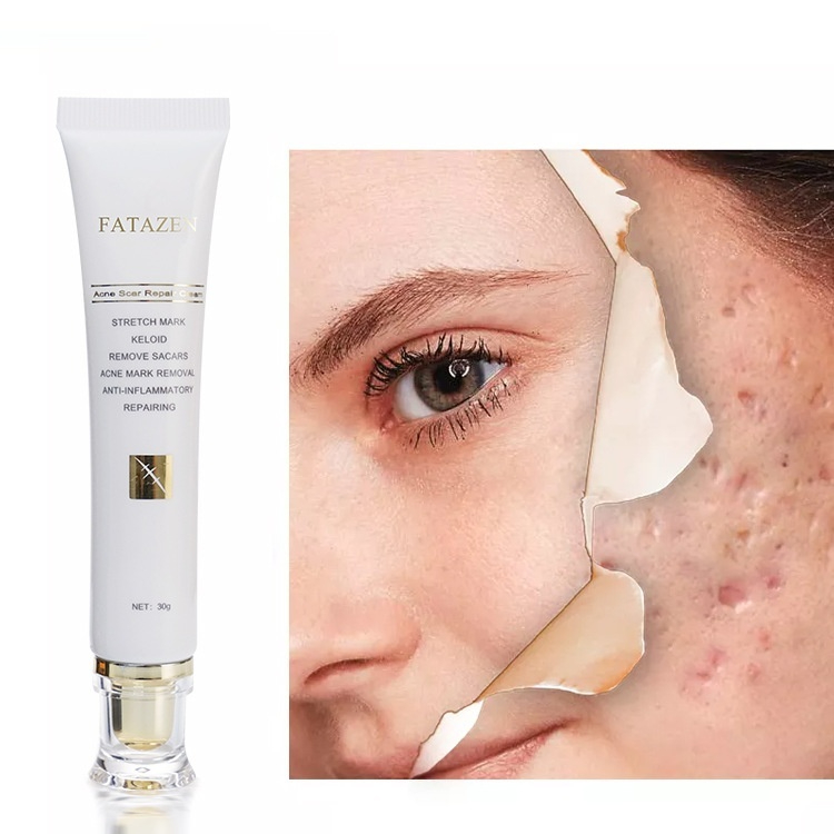 Desalination Scald Surgery Hyperplasia Remove New Scar Repairing Cream