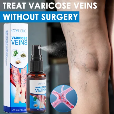 30ml Varicose Vein Spray Multi-Purpose Knee And Leg Care Spray Promote Blood Circulation