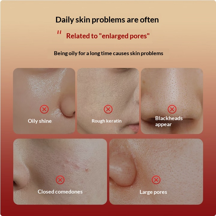 Centella Asiatica Pore-Tightening Serum For Clearing Blackheads