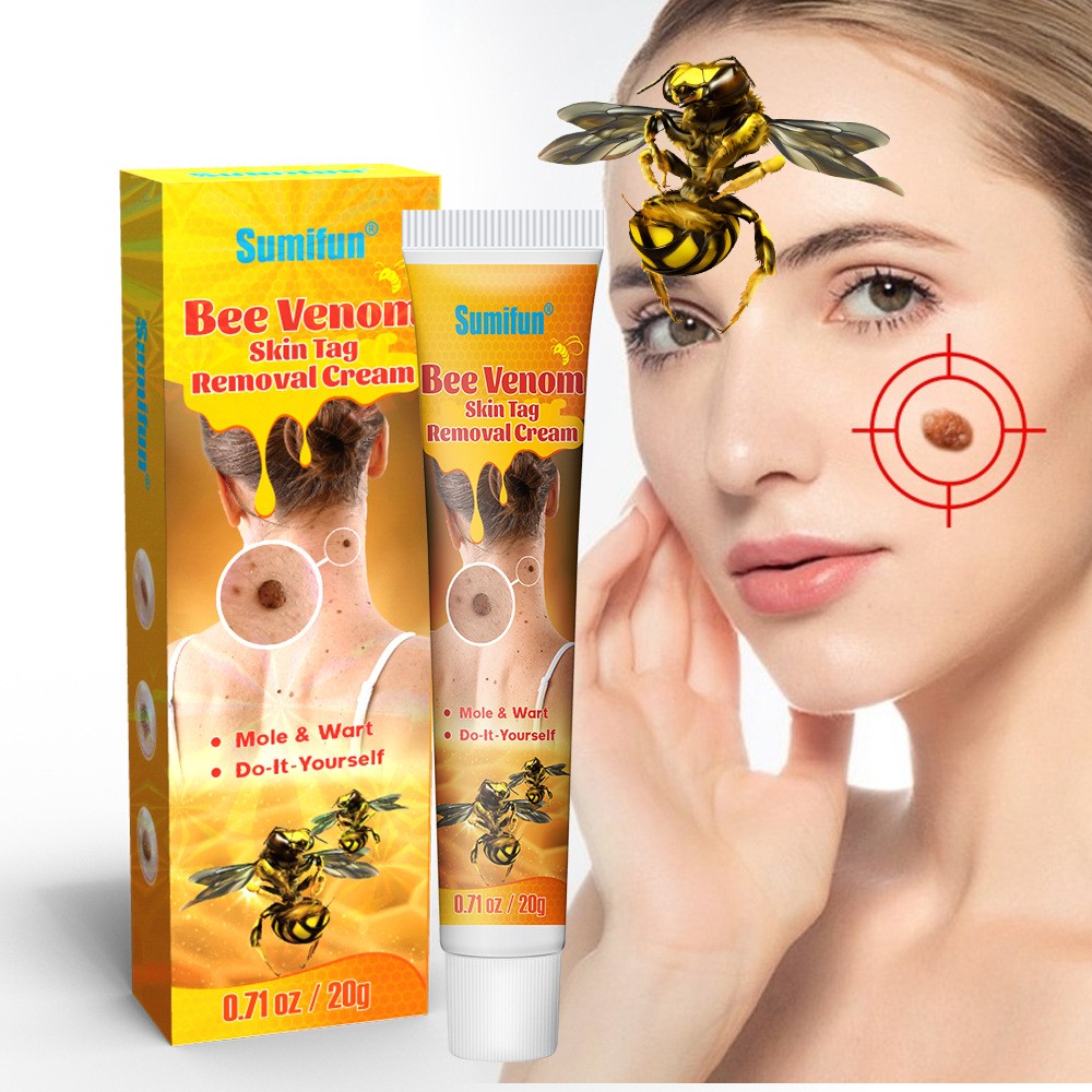 Herbal Wart-Removal Skin Care Cream For Wart Removal