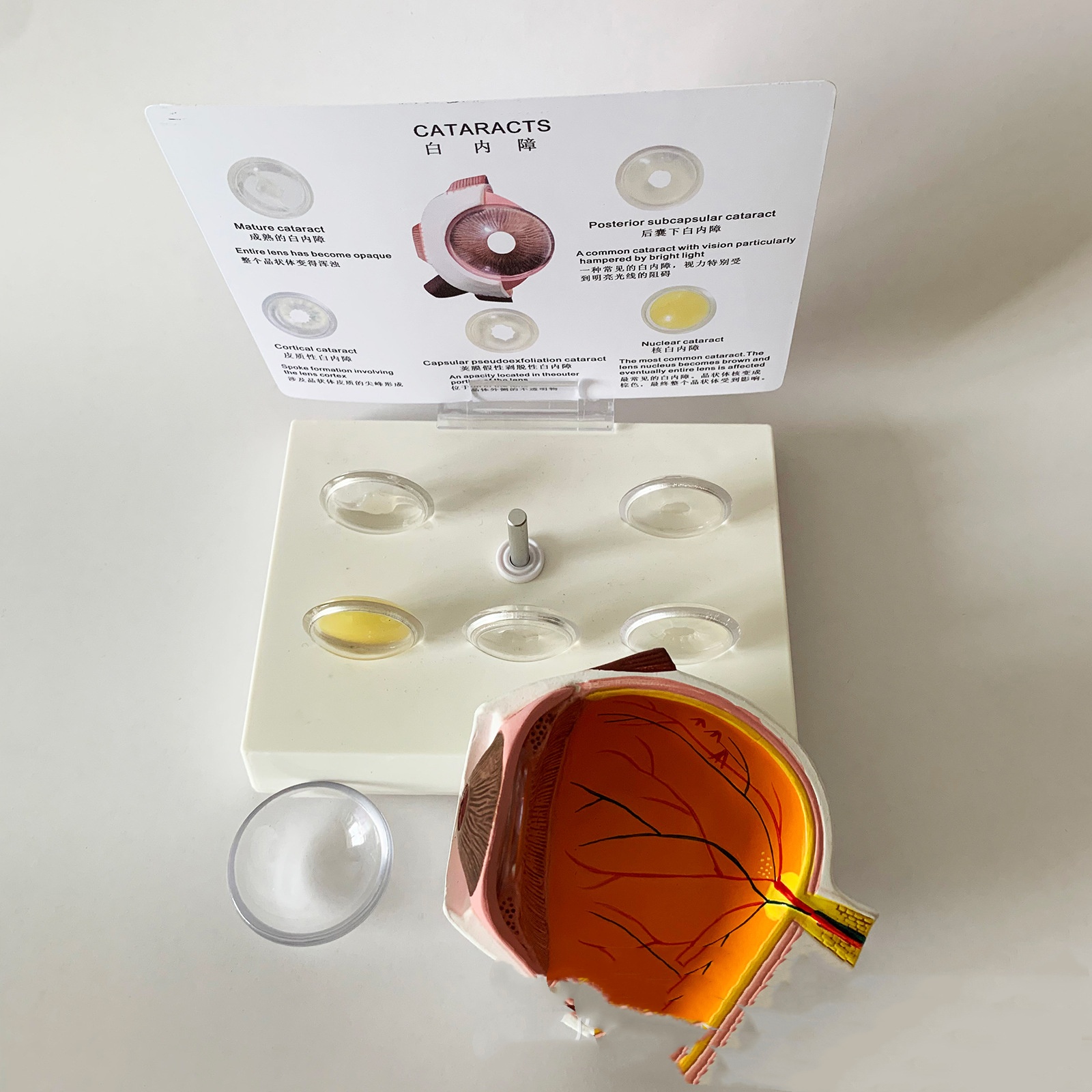 Cataract Eye Anatomical Model Lens (1pc)