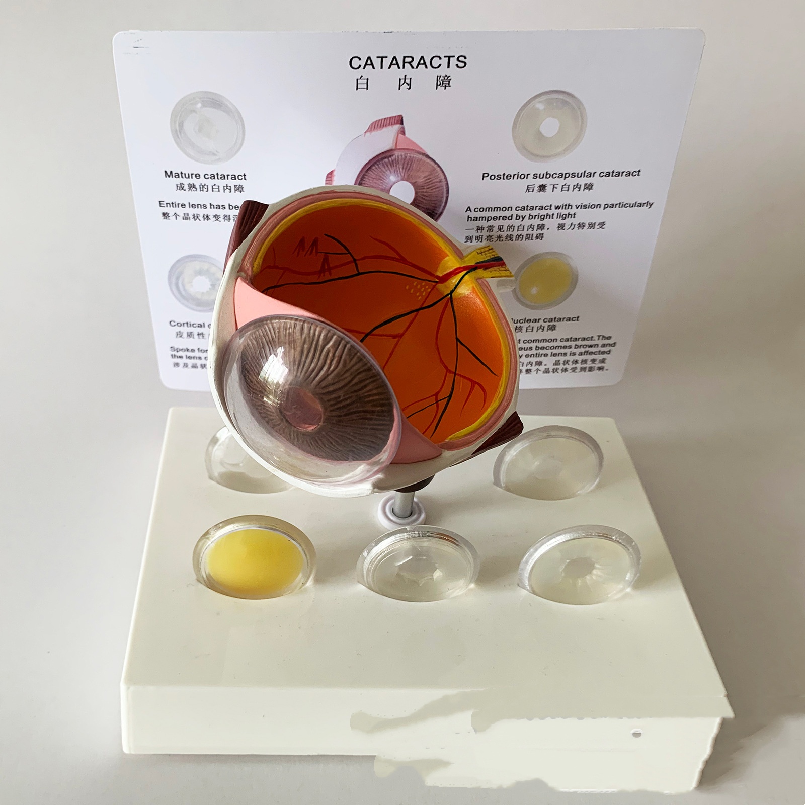 Cataract Eye Anatomical Model Lens (1pc)
