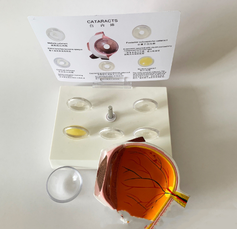 Cataract Eye Anatomical Model Lens (1pc)