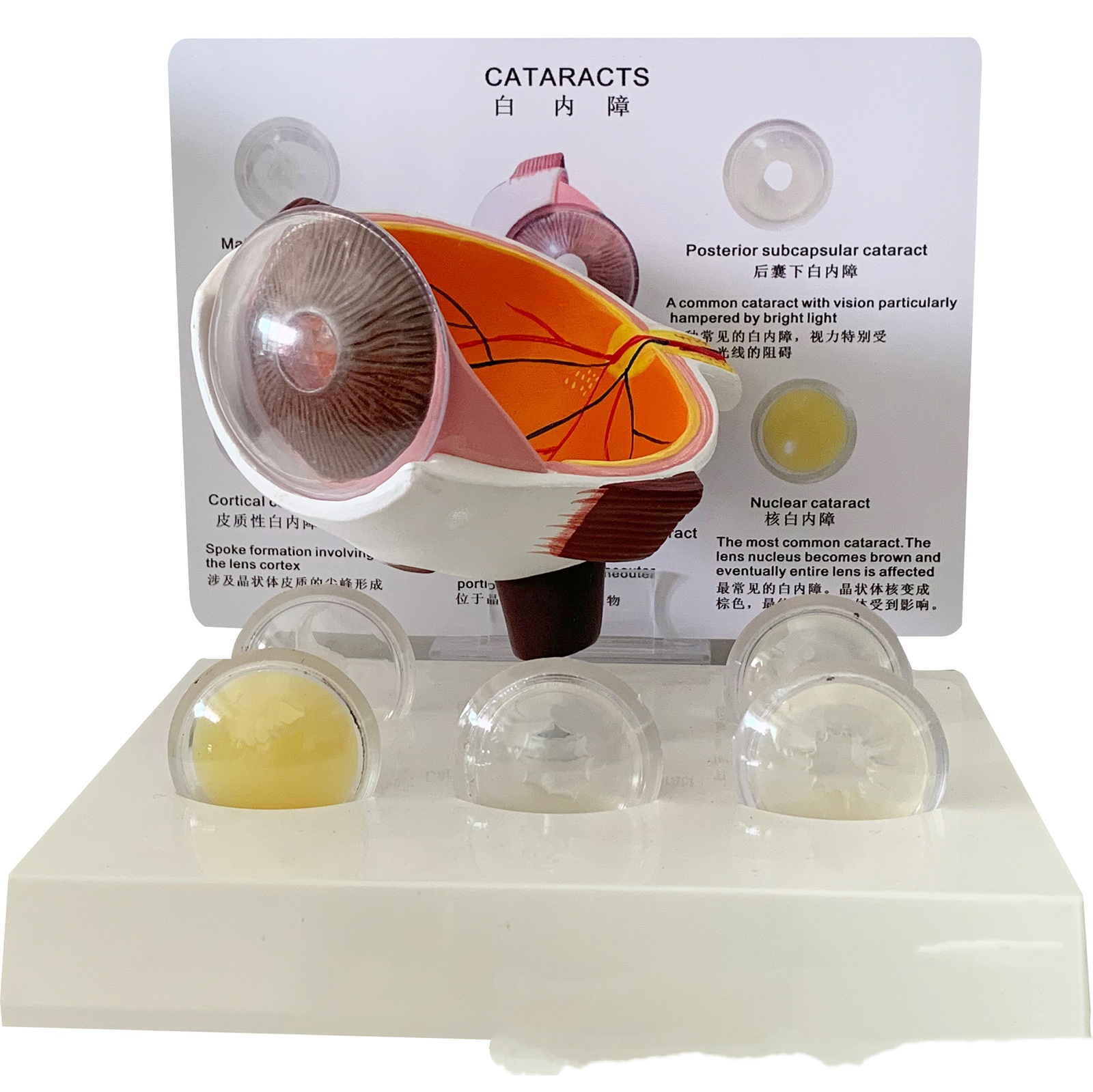 Cataract Eye Anatomical Model Lens (1pc)