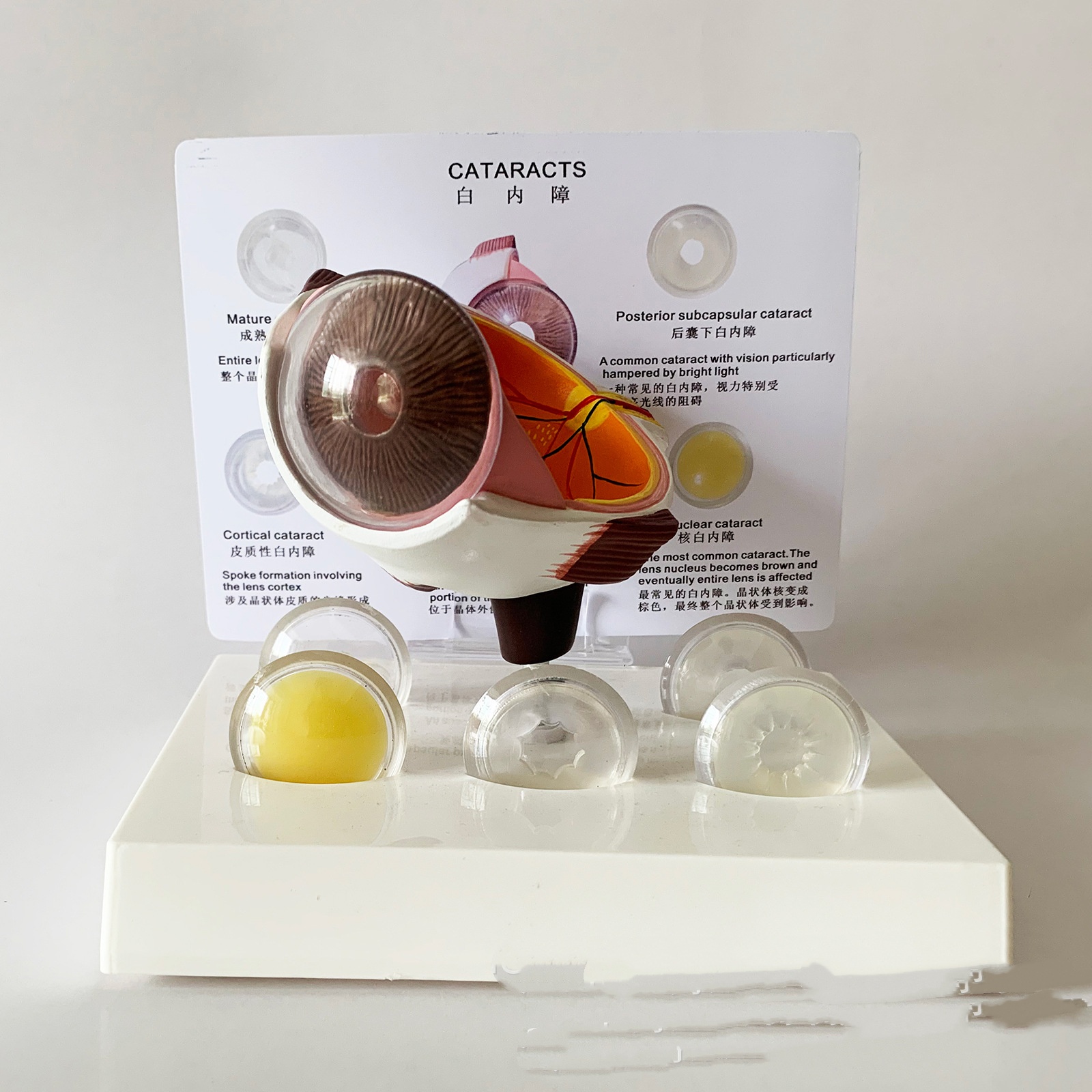 Cataract Eye Anatomical Model Lens (1pc)
