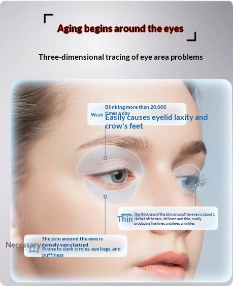 Eye Massager With Heat Therapy For Eye Bags And Dark Circles