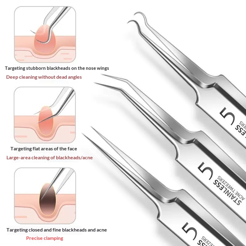 Pimple-removing Needle And Blackhead Cell Clip Set