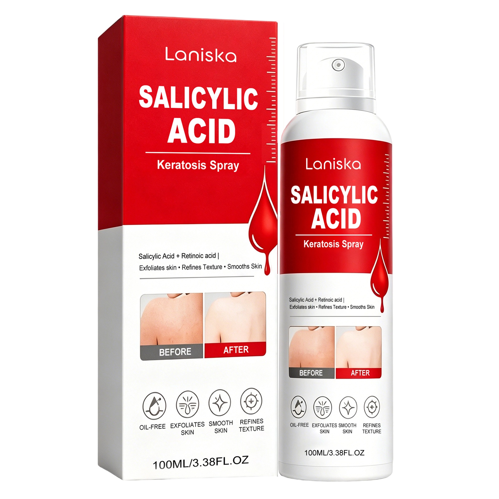 Smooth Skin Keratosis Spray