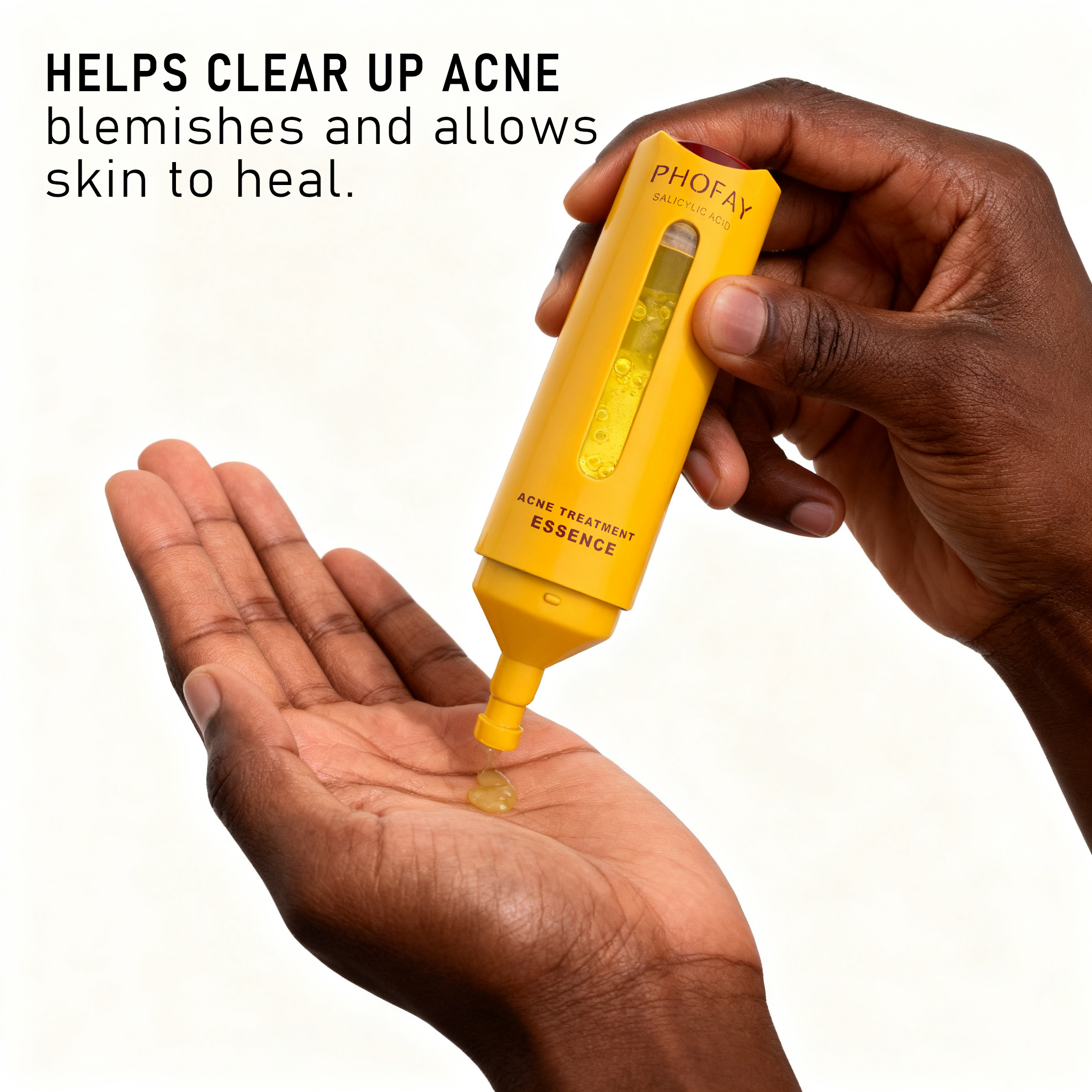 C-S002 Acne Removing image 8