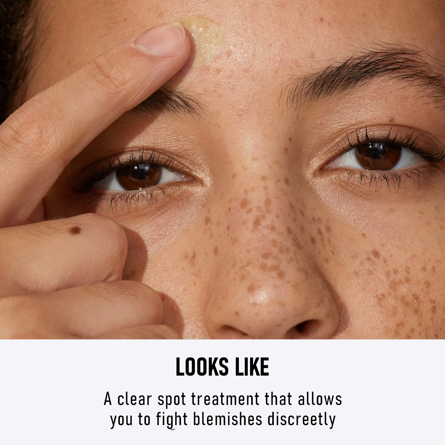 C-S002 Acne Removing